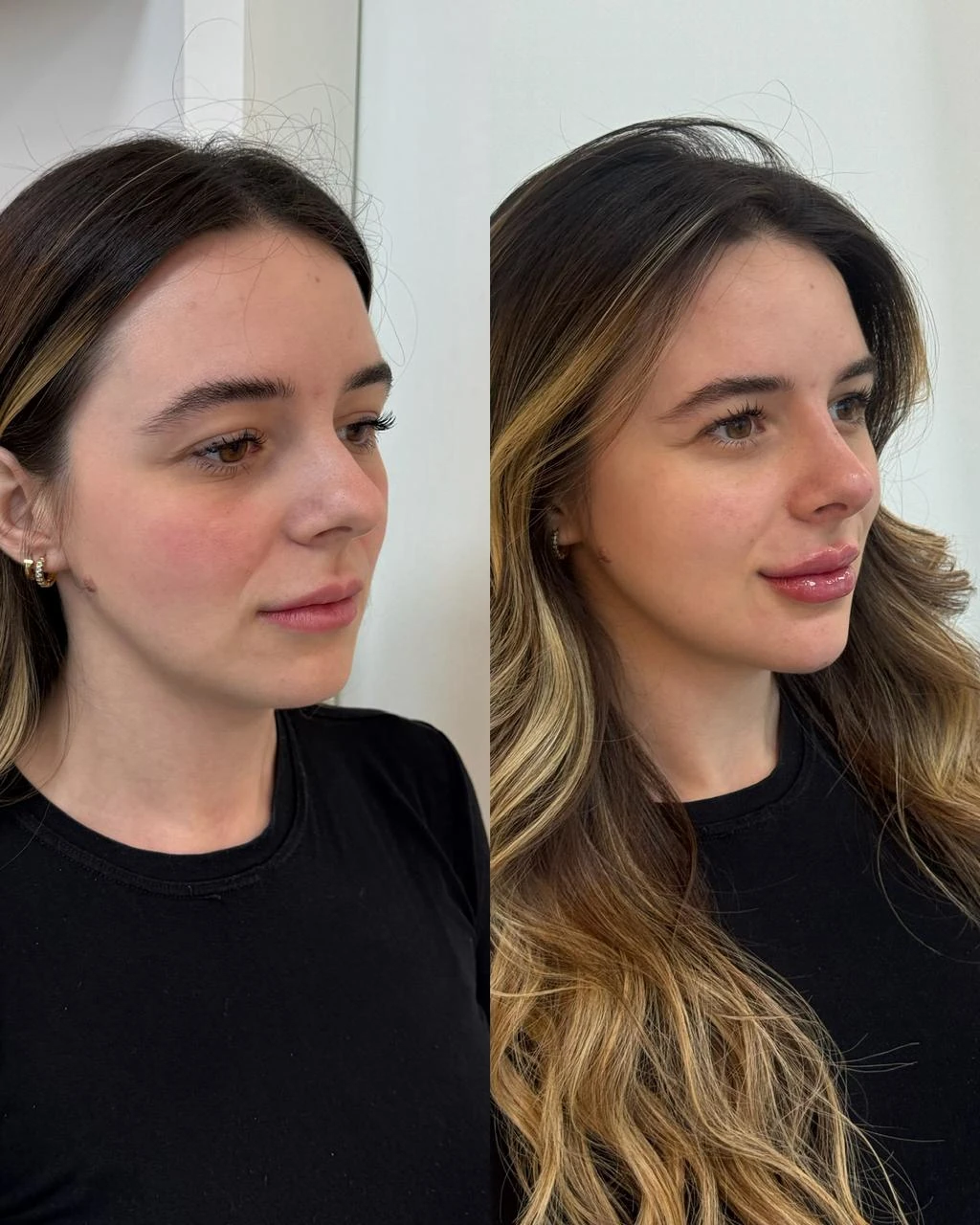 Resultado de Bioestimuladores