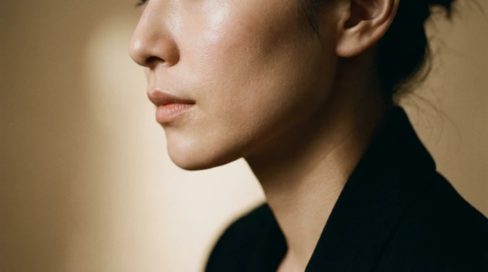 Paciente após procedimento de Harmonização Facial
